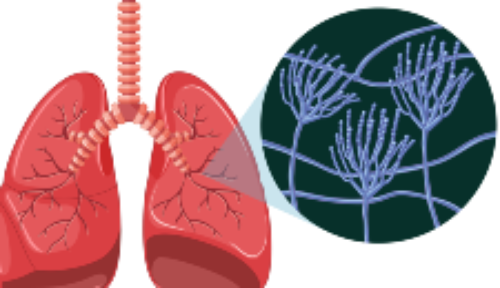 Por primera vez caracterizan microbiota de pulmón en lactantes aparentemente sanos