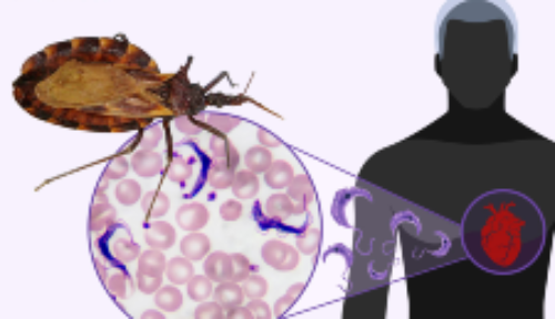Identifican tres biomarcadores sanguíneos que podrían predecir el daño cardíaco en la enfermedad de Chagas