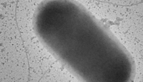 Patotipo de Escherichia Coli productor de Shigatoxina, imagen obtenida por el equipo de investigadores que trabaja con el doctor Roberto Vidal. 