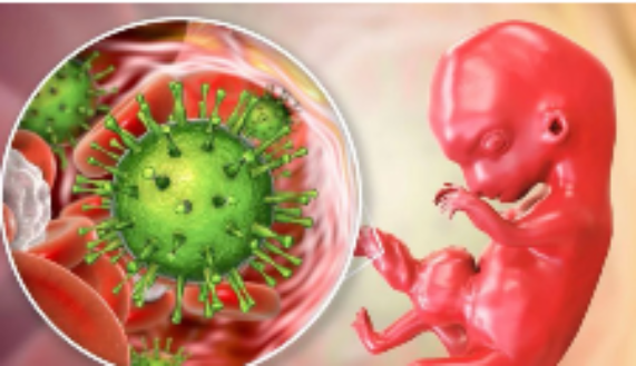 Si el citomegalovirus se reactiva en una mujer durante su primer trimestre de embarazo, o si se contagia en esta misma etapa, el recién nacido podría tener graves secuelas, explica la doctora Giannina Izquierdo. 